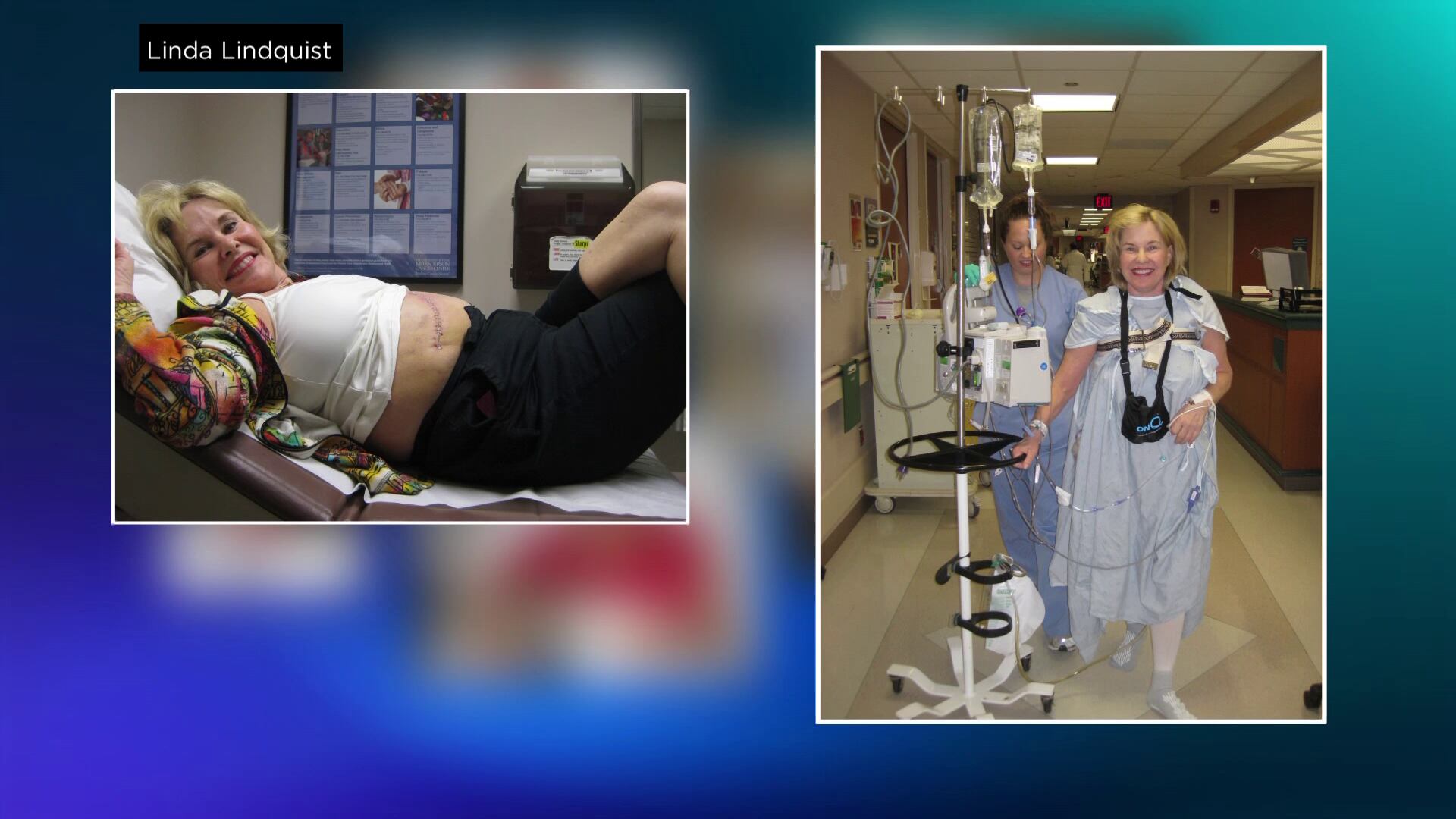 New Non-Invasive Therapy Offers Hope for Recurring Liver Cancer Patients