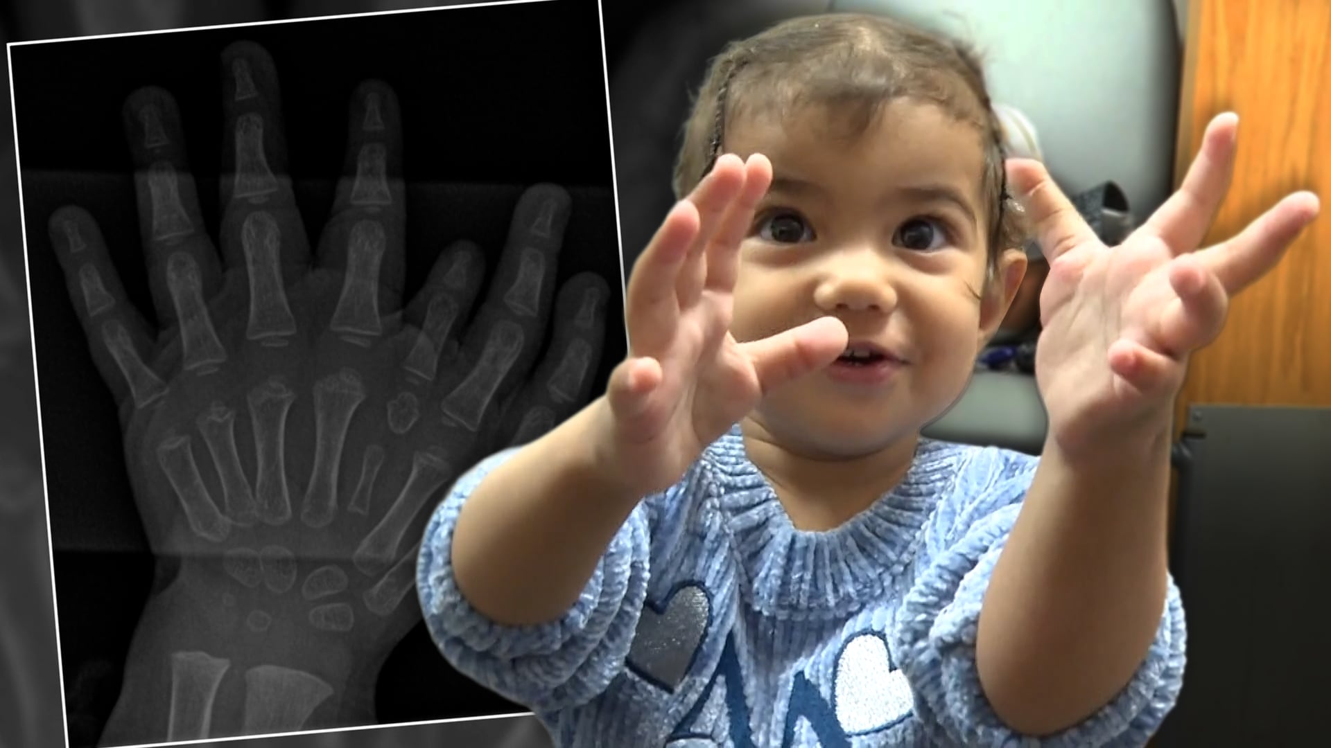 Family Travels From Turkey to St. Louis for Daughter’s Surgery