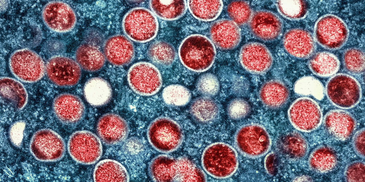 Health officials track Arizona’s first travel-associated case of Clade I mpox - AZ Family
