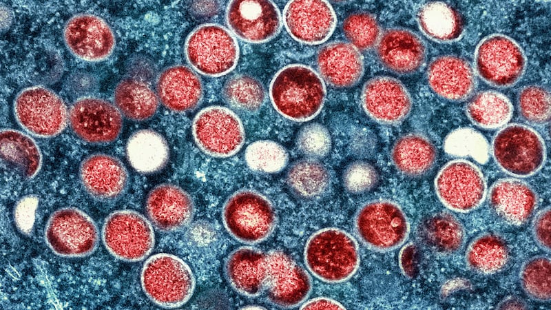 FILE - This colorized electron microscope image provided by the National Institute of Allergy...