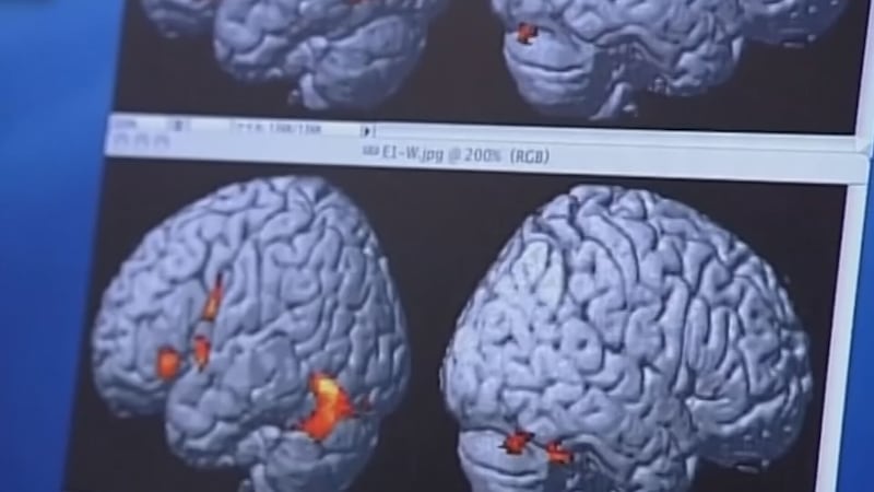 Arizona has the fastest growth rate for Alzheimer’s in the country.