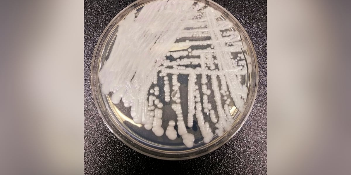 Arizona sees surge in ‘Superbug’ fungus cases, CDC data shows