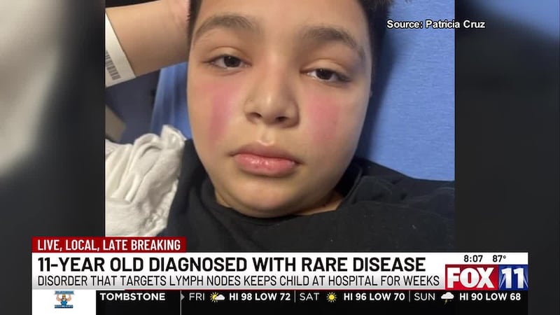 Tucson boy diagnosed with rare disease