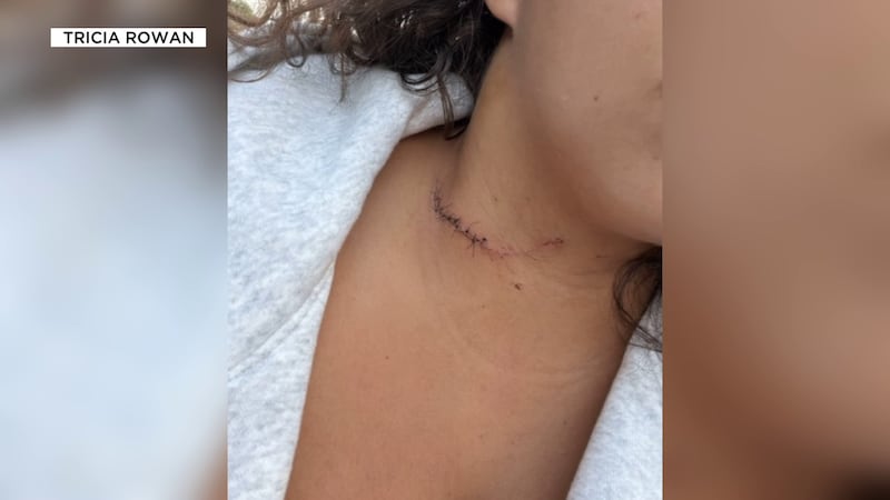 A woman was attacked while on a hiking trip near the Grand Canyon.