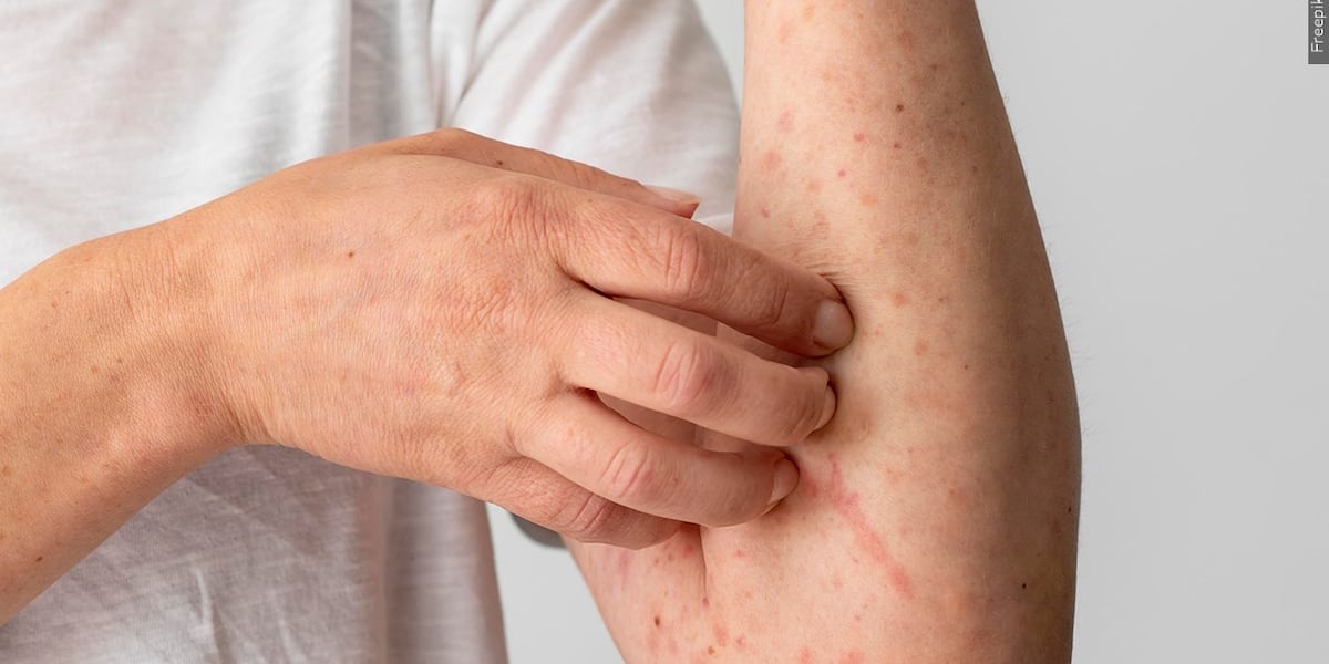 Chase Field, Chandler mall among new measles exposure sites in Maricopa County - AZ Family