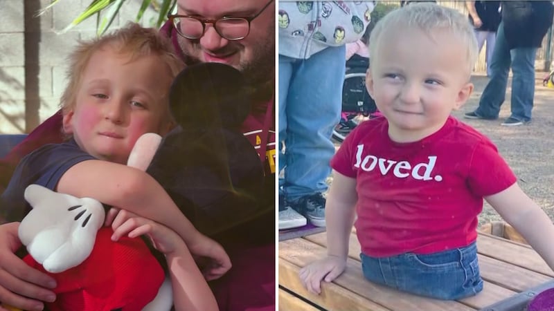 Six-year-old Oliver was born without legs due to Baraitser-Winter syndrome. He is also...