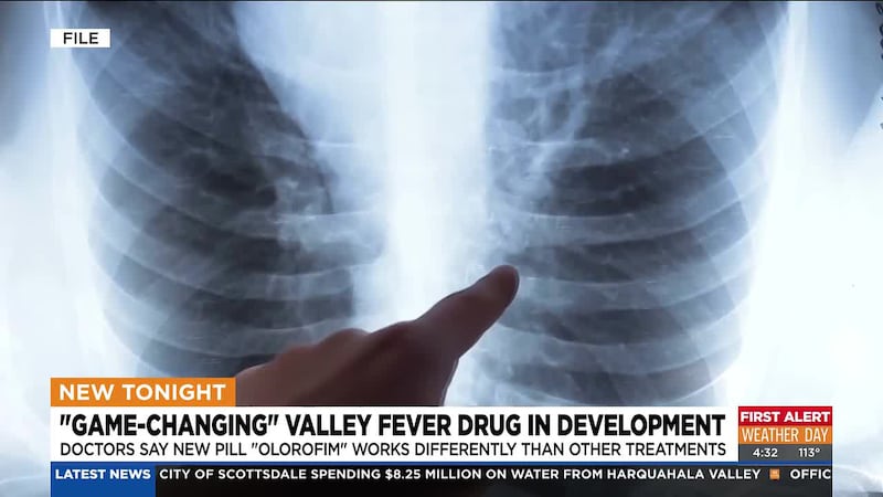 An Arizona-led study finds a new pill may offer new hope for patients battling severe valley...