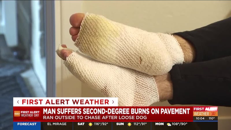 A Tempe man is recovering from second-degree burns on both feet after chasing his dog down the...