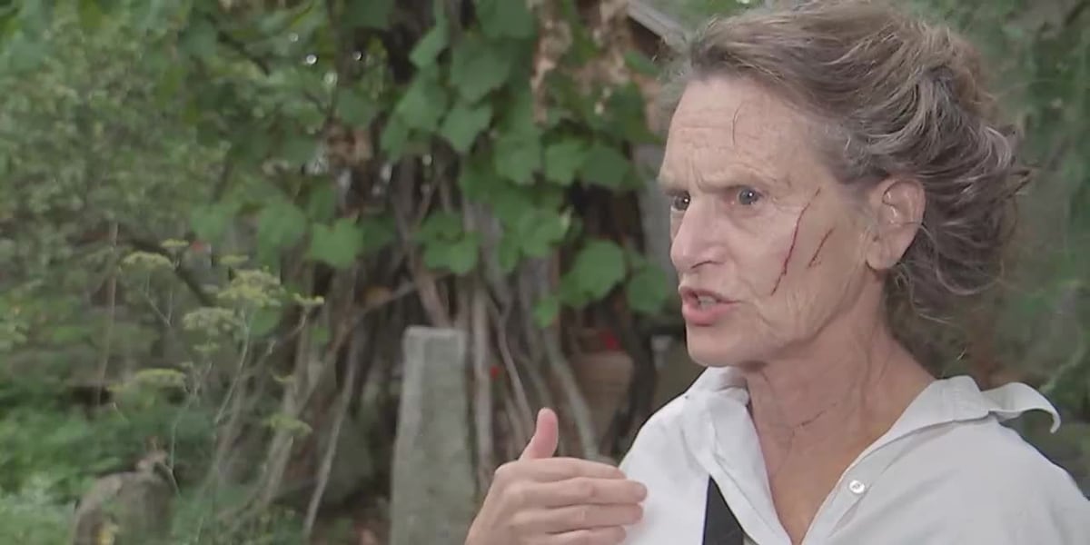 Somerville Woman Attacked by Raccoon on Porch