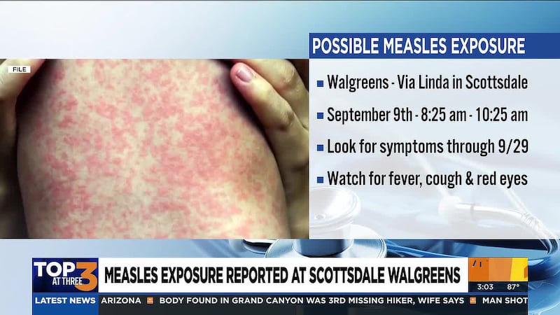 A possible measles exposure occurred at the Walgreens on Via Linda, near Shea and Frank Lloyd...